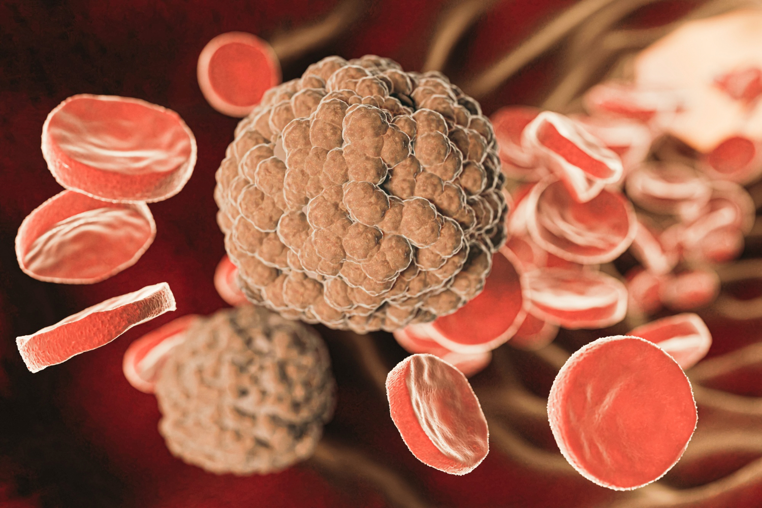 Soft Tissue Tumors